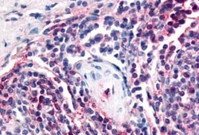 Immunohistochemistry-Paraffin: Attractin Antibody [NBP3-14547]